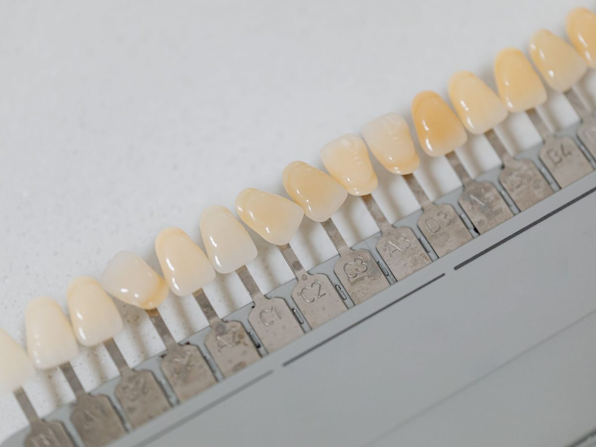 A shade guide used to measure tooth color